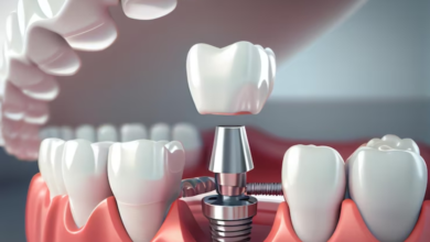 The Psychological Journey of Adapting to Oral Implants
