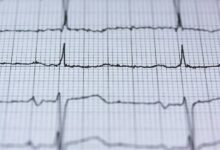 stellar fusion energy weapon